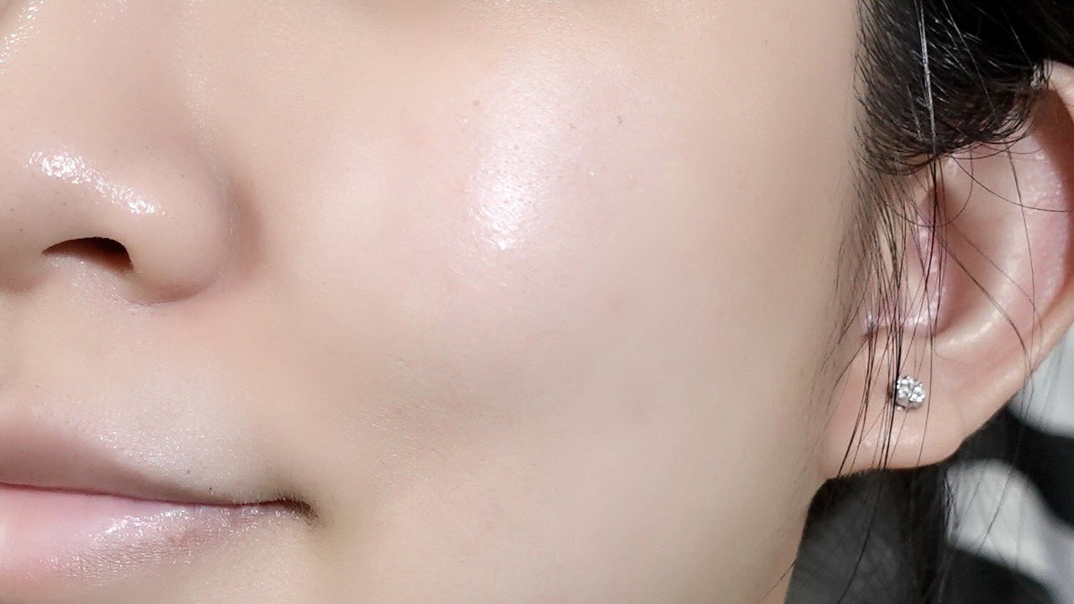 kynnsk's tweet photo. พลัง Eucerin สุดๆ เรื่องสิวหายไวแบบข้ามคืนไว้ใจเค้าได้เสมอ นี่คือปจดจะมา + ออกไปเจออากาศร้อนบ่อย สรุปสิวเห่อค่า 🥲 หยิบน้องคนนี้มาใช้ ก็สมชื่อ Eucerin SOS Serum ช่วยกู้ผิวได้ดีมากๆ สิวยุบไวแบบข้ามคืน ไม่ทิ้งรอยสิวไว้ด้วย ช่วยลดการอักเสบของผิว รักษาสิวแบบไม่ทำให้ผิวแห้งลอก เนื้อเบาสบาย ซึมไว ไม่เหนอะหนอะ เริ่ด! #EucerinThailand #EucerinSOSserum #EucerinSOSserumจัดการสิวเร่งด่วนใน8ชม