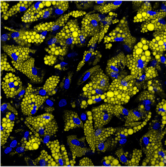 Fat cells are beautiful 😍 

📸: @BartDeplancke