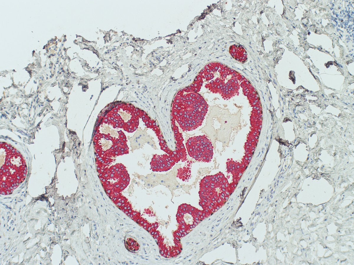 Lorraine Colón Cartagena tweet media