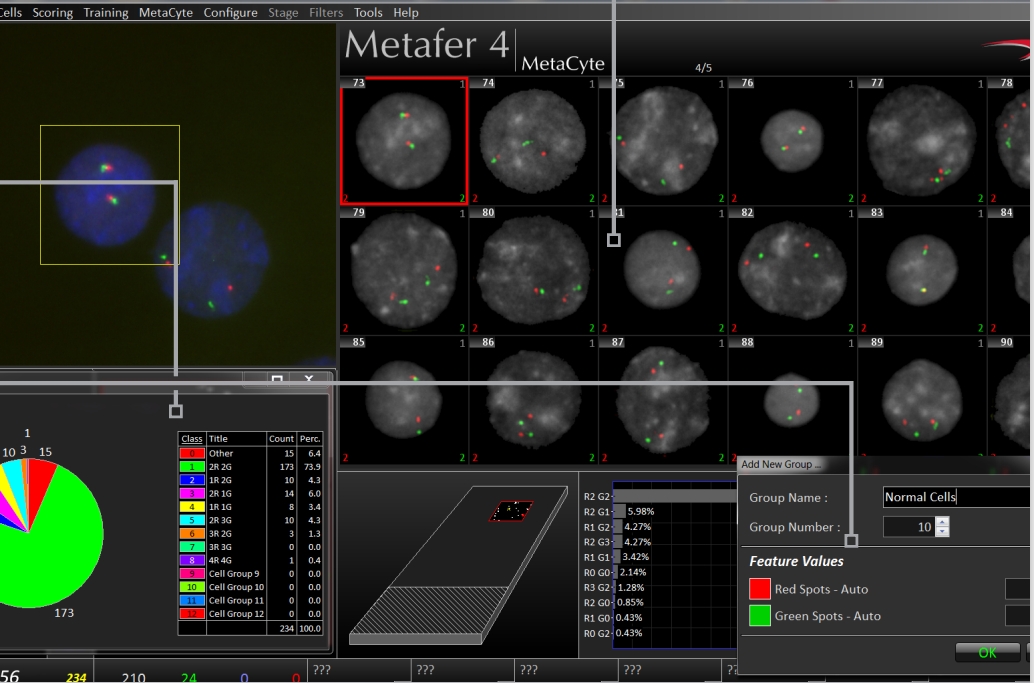 microxchile's tweet photo. La automatización es clave p/ evaluar las señales FISH con info valiosa y @metasystems_int presenta con el paquete de personalización de #SpotCounting, una propuesta de flujo de trabajo de #Metafer p/ abordar todos los desafíos del proceso y agilizarlo!
👉https://t.co/ADt0mAnAwB https://t.co/BUx9549TDT