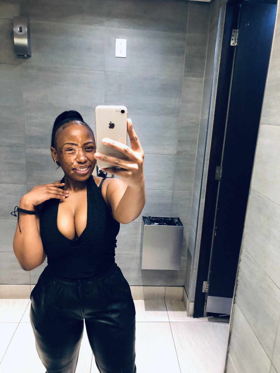 Katli_Atile's tweet photo. A rare picture of a Natural Beauty Hun in #SouthAfrica 🥵.. No weave No Make up nor touch up 

#blackandwhite #Skin #art #vitiligo #pieceofart #period https://t.co/A4SGOpv5LY