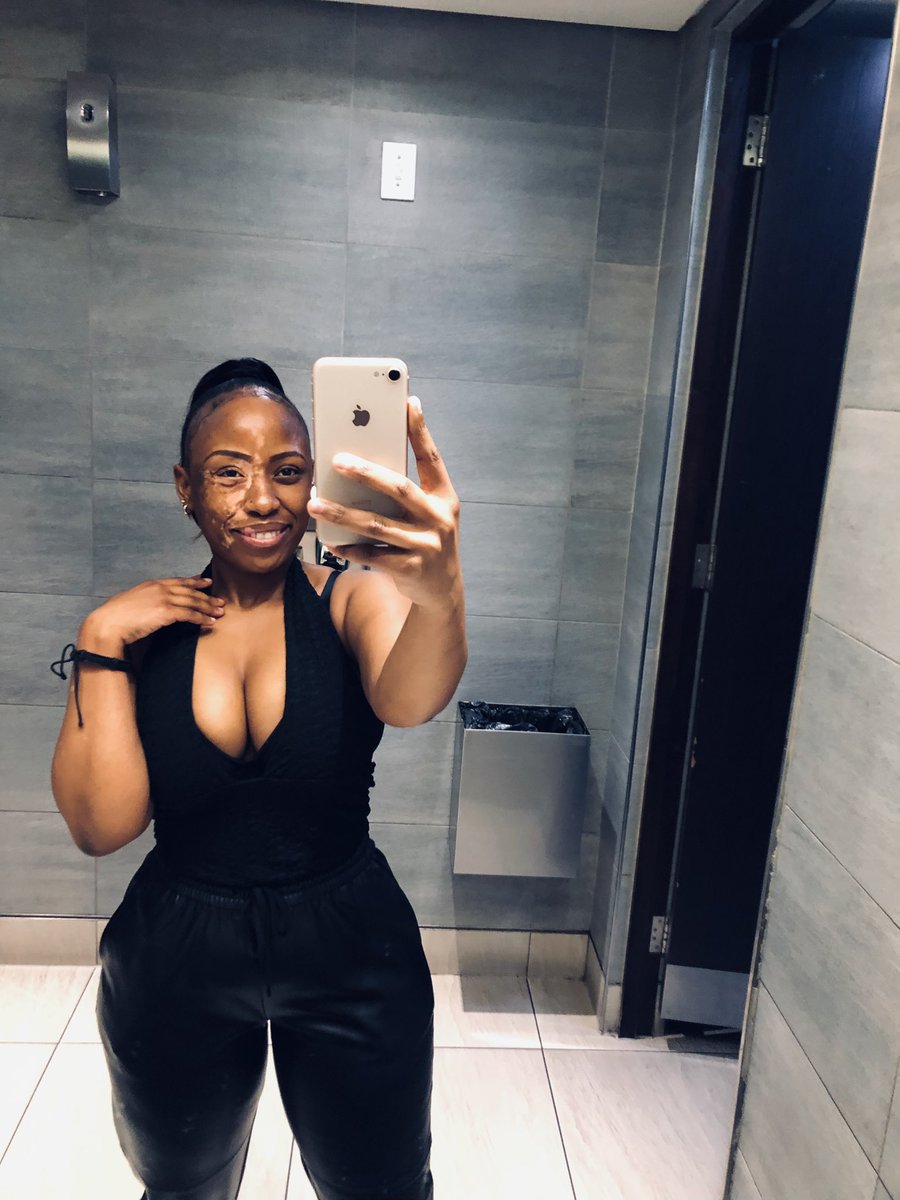 Katli_Atile's tweet photo. A rare picture of a Natural Beauty Hun in #SouthAfrica 🥵.. No weave No Make up nor touch up 

#blackandwhite #Skin #art #vitiligo #pieceofart #period https://t.co/A4SGOpv5LY