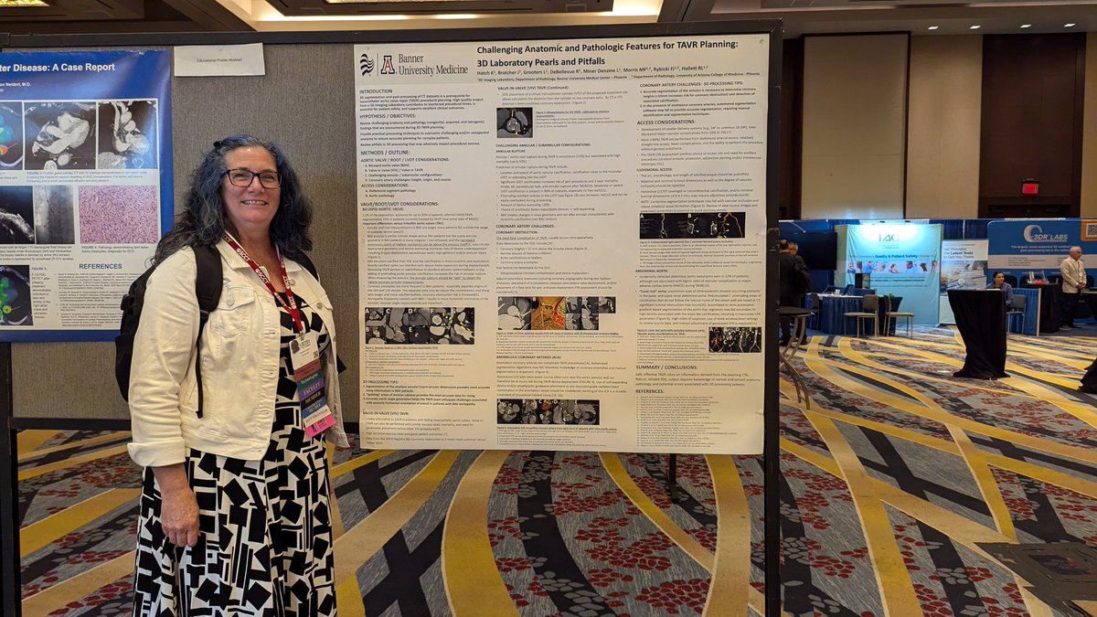 nweber_12's tweet photo. Incoming SCCT #CVCTTechEd committee chair Kimberly Hatch representing the 3D technologists role in #YesCCT at #SCCT2024 👏🏻 https://t.co/WU77GHe5pl