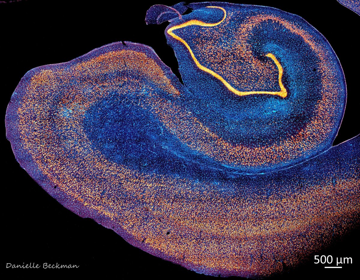 All my love and obsession for these 2 brain regions below: the Hippocampus and Entorhinal Cortex. They are some of the most important regions in the brain for memory and cognition. They are also part of the olfactory cortex and can receive some viruses directly from the olfactory