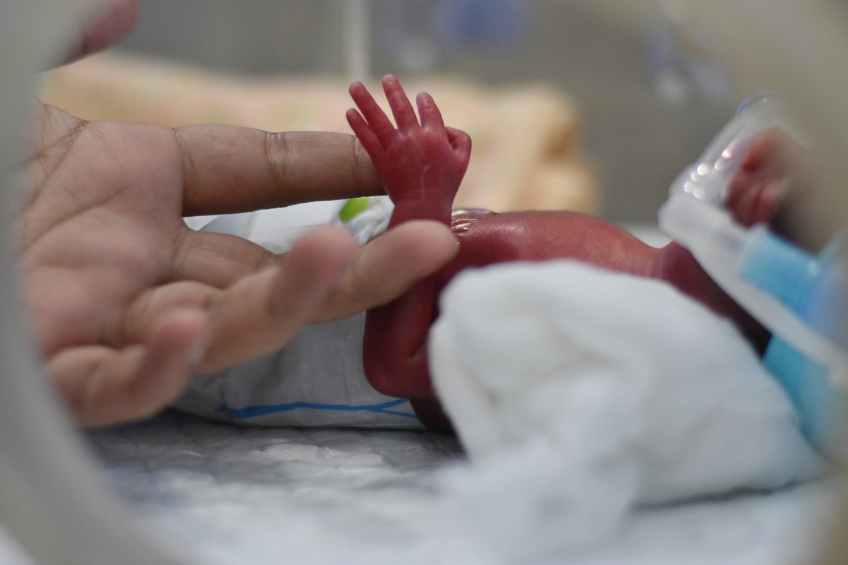Genetics in Medicine (@gimjournal) on Twitter photo Safety-net NICUs need access to high quality genetic care. Cost continues to be a barrier to implementing rapid #genome and #exome sequencing bit.ly/4bPXu7A #healthequity #genetictesting <a href="/HereAtMonica/">Monica Hsiung Wojcik</a> Safety-net NICUs need access to high quality genetic care. Cost continues to be a barrier to implementing rapid #genome and #exome sequencing bit.ly/4bPXu7A #healthequity #genetictesting <a href="/HereAtMonica/">Monica Hsiung Wojcik</a>