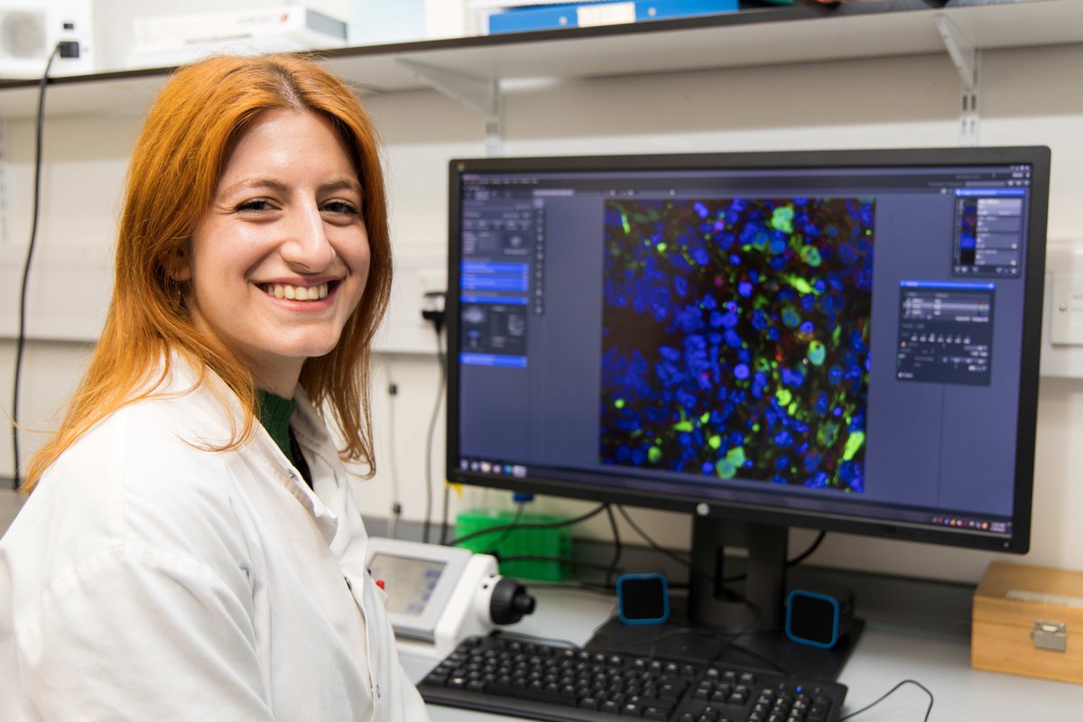 During Glioblastoma (GBM) Awareness Week, we are proud to announce that research at one of our <a href="/QMUL/">Queen Mary University of London</a> Centres of Excellence has led to a breakthrough discovery regarding glioblastoma (GBM) brain tumours.

Read about this breakthrough ➡️ bit.ly/4d8invs..