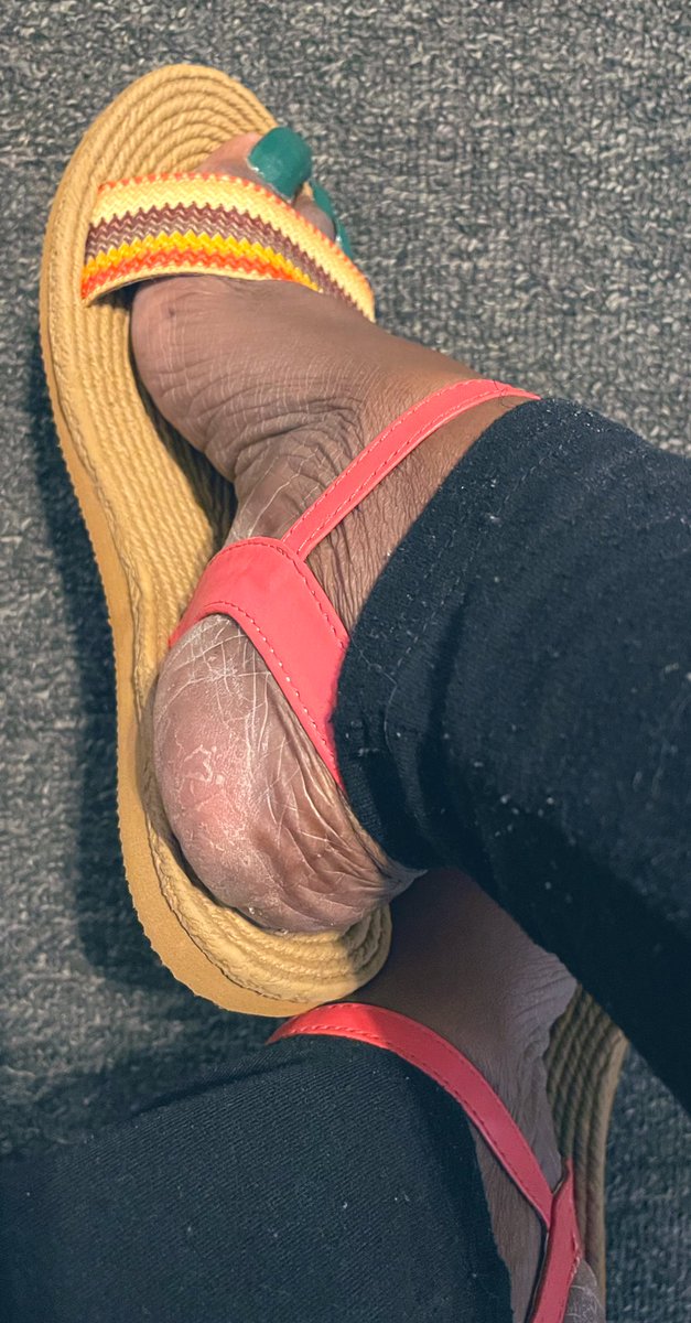 AsmrPrettyfeet's tweet photo. Ashy😩
#dryfootheels
#ashyheels
#prettyheels
#prettyfeet
#longtoenails https://t.co/ATSl8uQGE4