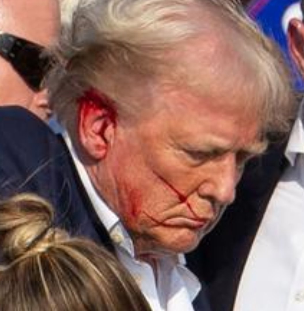 vizslaatchoo's tweet photo. @newscomauHQ Top half of his ear hit. With a bandage on, looks like no damage ..... https://t.co/roN7csdkOv
