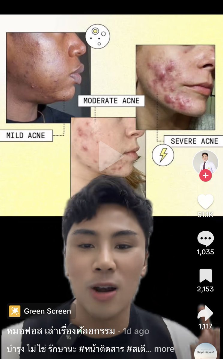 คือคนเตือนเยอะมาก หมอก็ออกมาบอกแล้ว หมอฟอสบอกว่านี่คือสิวขั้นรุนแรงแล้วมีการติดเชื้อ(เชื้อรา)ร่วมด้วย เพราะมีอาการคันก็ค่อนข้างชัด ต้องไปหาหมอแล้ว ถ้ากลัวหมอคลีนิค ไม่มีเงิน คือไปโรงพยาบาลได้เลย ใช้สิทธิได้เลยคือโรคผิวหนังแล้ว