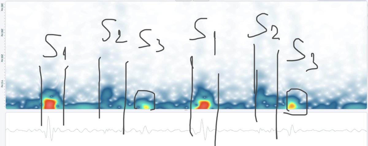 Stethophone tweet media