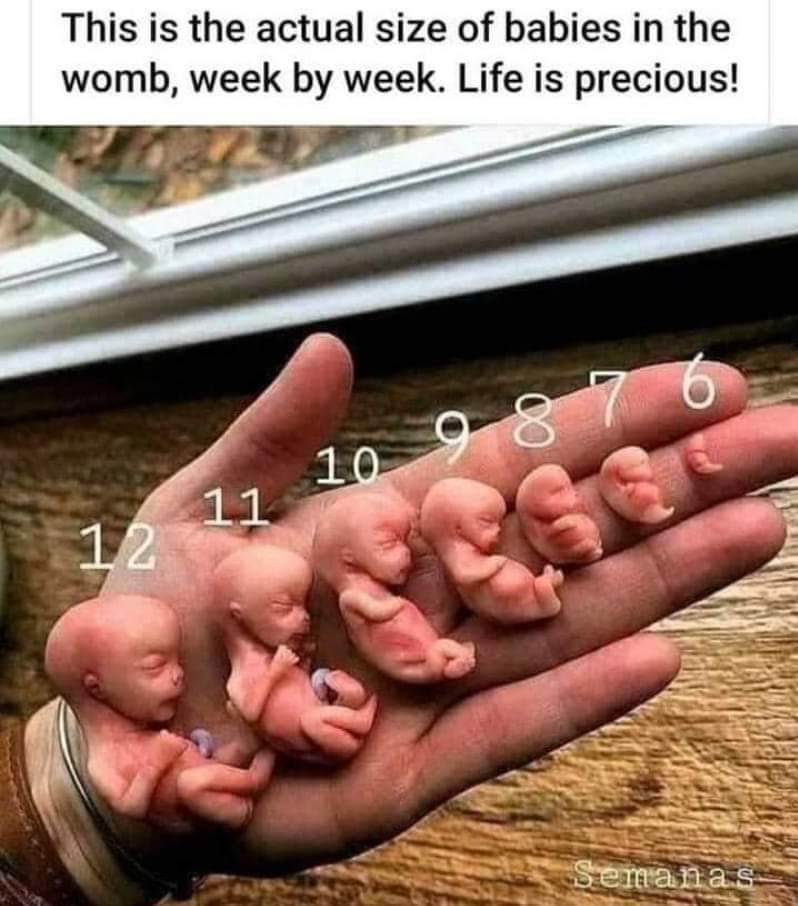 MsRufinWORK's tweet photo. Fight for life!
#PROLIFE https://t.co/O399lnlp5H