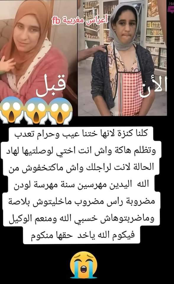Asmae17668's tweet photo. كلنا كنزة عطيوها حقها كمواطنة مراة مغربية حرة
القصة وما فيها ان هذه السيدة  مسكينةجات تخدم عندهم في
 الدار   هرسوها من يدها وطيحوا ليها سنانها https://t.co/BxZXT1kATr