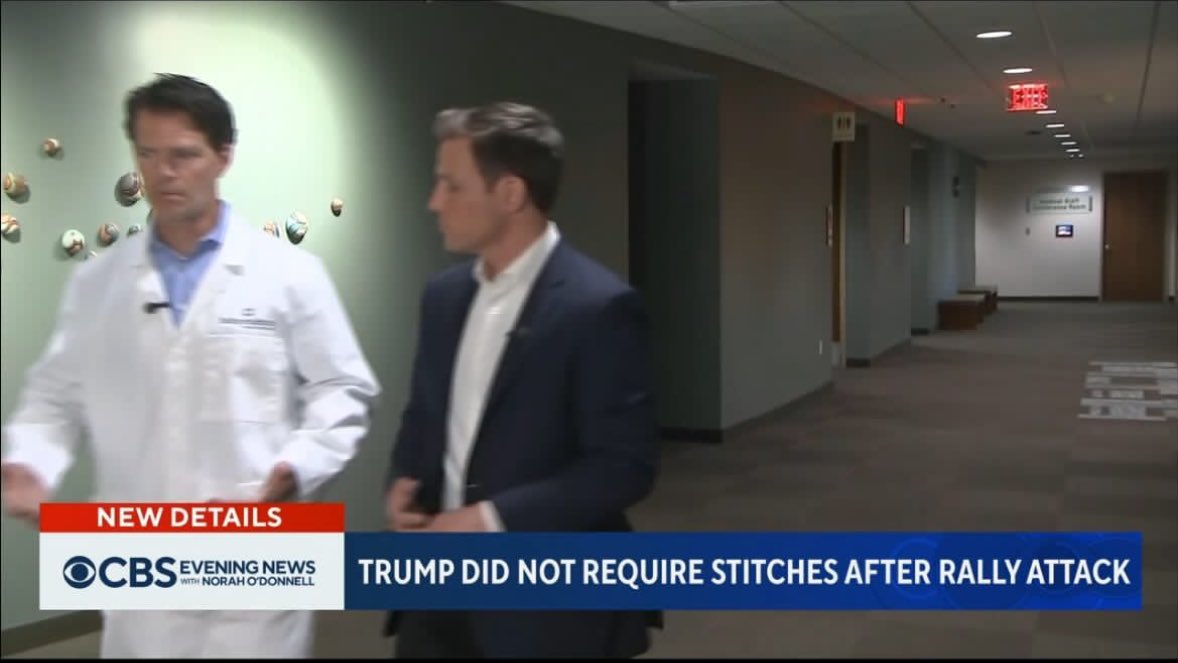 Watching CBS News. The doctor who treated TFG said he "didn't even need stitches."

What the fuck