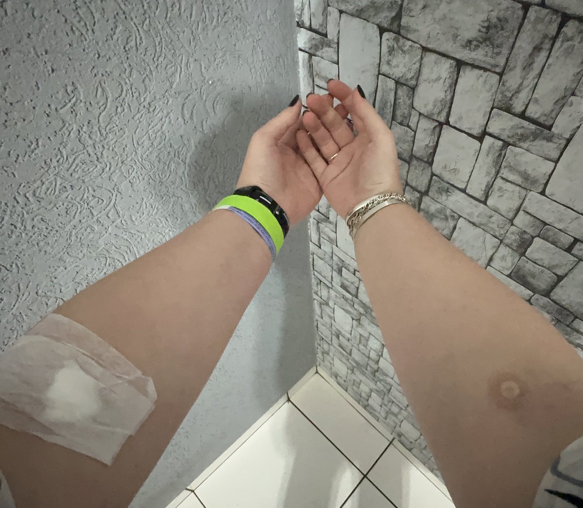Não basta ter pavor absurdo de agulha, tem que ir na emergência tirar sangue, ter acesso venoso e injeção de contraste sem preparação psicológica nenhuma.
