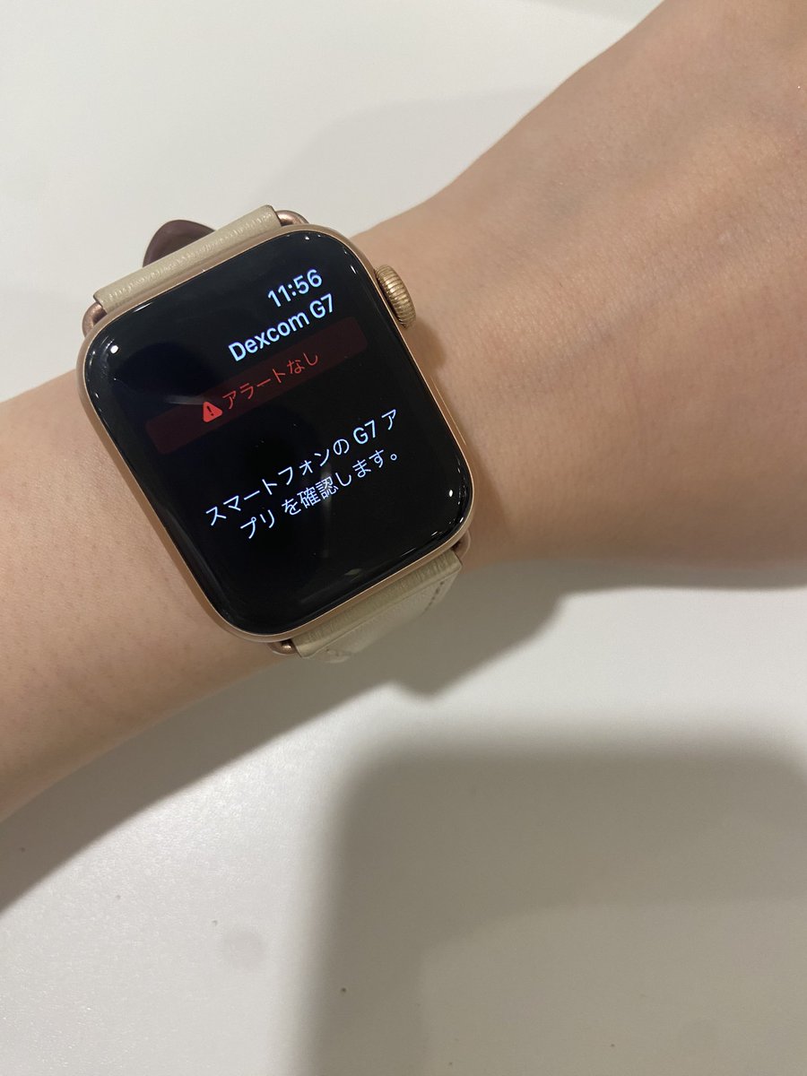 20180902_iddm's tweet photo. は〜Apple Watchで見れない
アプリを確認しても分からない🤷

自分が機械音痴すぎるのかな😭😭 https://t.co/KRMV9DWKso