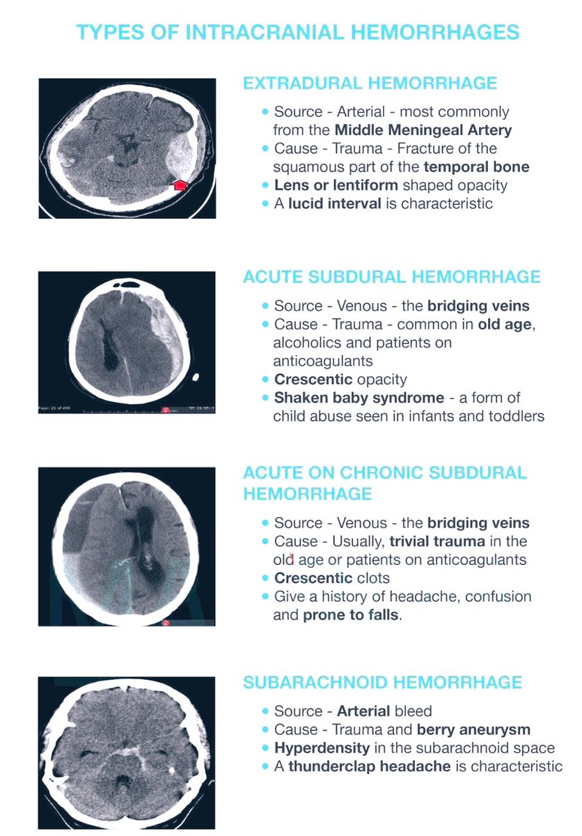 Doctors__squad's tweet photo. TYPES OF INTRACRANIAL HEMORRHAGES 📌 https://t.co/zBfe891kVQ