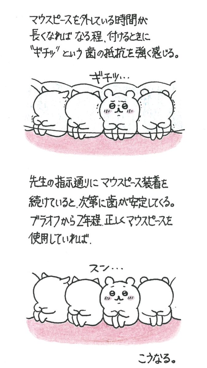 Stephanolepiens's tweet photo. 後戻り防止のために、ブラオフ後は指示通りのマウスピース(リテーナー)装着が非常に重要だというお話。体験談です。

#歯列矯正
#抜歯矯正

(ちいかわちゃん描いてみたい欲がずっとあったので、歯の役をやってもらいました。) https://t.co/gsmcdL61p1