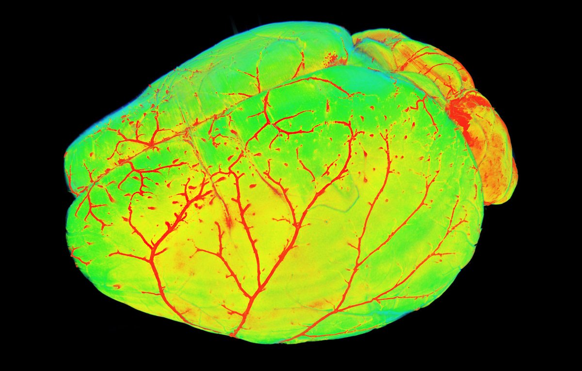 Sama_Books's tweet photo. Mouse brain vasculature

Source : Dr. Ali Erturk

#Science #neurotwitter #neuroscience #fluorescence #MedTwitter #microscopy #Scitwitter https://t.co/DCsfqEjaAM