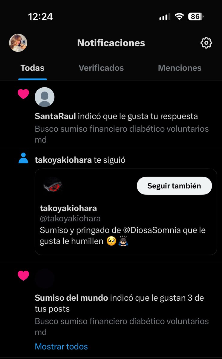 QUE ES ESTO DJSJSJSJSJS
