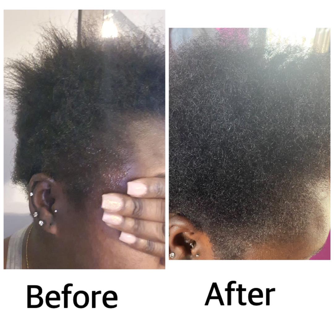 DermaSolutiongh's tweet photo. For the treatment of dandruff, itchy scalp, breaking hair and all scalp psoriasis 

Use derma anti-dandruff hair cream
 
2 for Ghc 60 

DM or Call 0205773069 

#DermaSolution
#Newsfile #GhanaXLeague #leak #TelecelMoreMoney https://t.co/bOPGNB0Acc