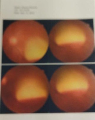 #رتويت قبل تقرو⭕️ من الDM:
السلام عليكم ورحمة الله وبركاته
كيفك 
أسأل الله أنكم بخير
انا اسمي علي حسين حسن طبيب من الإسلامية الدفعة ٢٧

محتاج مساعدتك في شي طارئ وضروري عجزنا عنه
انا واهلي قطعنا كل العندنا وبعنا العندنا والما عندنا لأننا محتاجين قروش ضروري جدا لعملية بتاعت أختي في