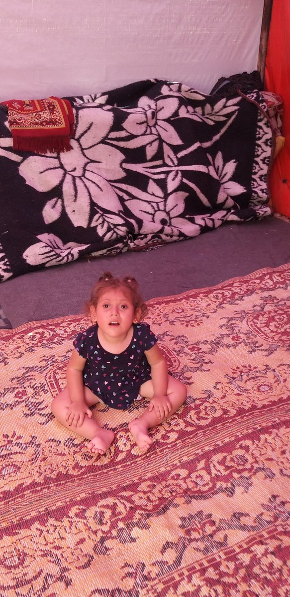 Pineapples911x's tweet photo. A part of Jannah’s brain is not covered by bones that are important to protect her brain from shocks and changes in temperature.

When I say she is suffering in the heat of the tents, she is suffering. Please help her get surgery.

100SEK = $10

https://t.co/TJa1u0JIlX https://t.co/HpYsYkwxyb