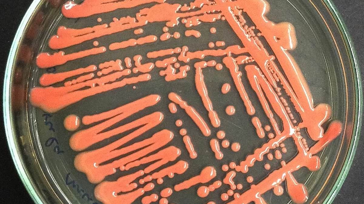 DailyMail's tweet image. Never-before-seen fungus that mutates at 'hyper' speed is discovered in China as two patients die with it trib.al/t70q0xe