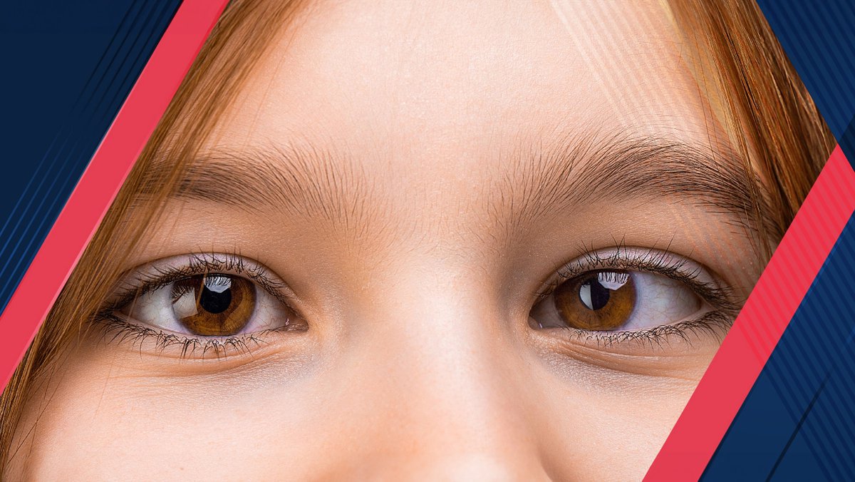 Discover squint diagnosis and treatment at Medeor Hospital Dubai. Our expert team offers personalized care and advanced treatments for optimal eye health. Read our latest blog.

🔗 medeor.ae/illuminating-s…

#MedeorDubai #EyeHealth #SquintTreatment #VisionCare #Healthcare