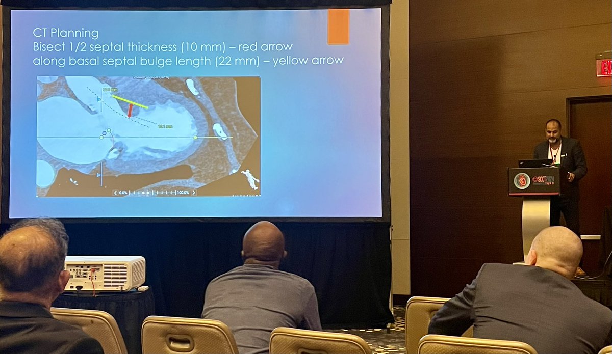 Pravin Patil (@pravinp8) on Twitter photo TMVR Imaging masterclass with <a href="/OKhaliqueMD/">Omar Khalique</a> at Joint <a href="/ASE360/">American Society of Echocardiography</a>/#SCCT2024 session. ViMAC case with EtOH/SESAME/LAMPOON septal and LVOT preserving therapies.. Great session <a href="/LinWangMDNY/">Lin Wang MD,FASE,FACC</a> <a href="/PraveenRangana9/">Praveen Ranganath, MD</a> <a href="/RenukaJain6/">Renuka Jain</a> TMVR Imaging masterclass with <a href="/OKhaliqueMD/">Omar Khalique</a> at Joint <a href="/ASE360/">American Society of Echocardiography</a>/#SCCT2024 session. ViMAC case with EtOH/SESAME/LAMPOON septal and LVOT preserving therapies.. Great session <a href="/LinWangMDNY/">Lin Wang MD,FASE,FACC</a> <a href="/PraveenRangana9/">Praveen Ranganath, MD</a> <a href="/RenukaJain6/">Renuka Jain</a>