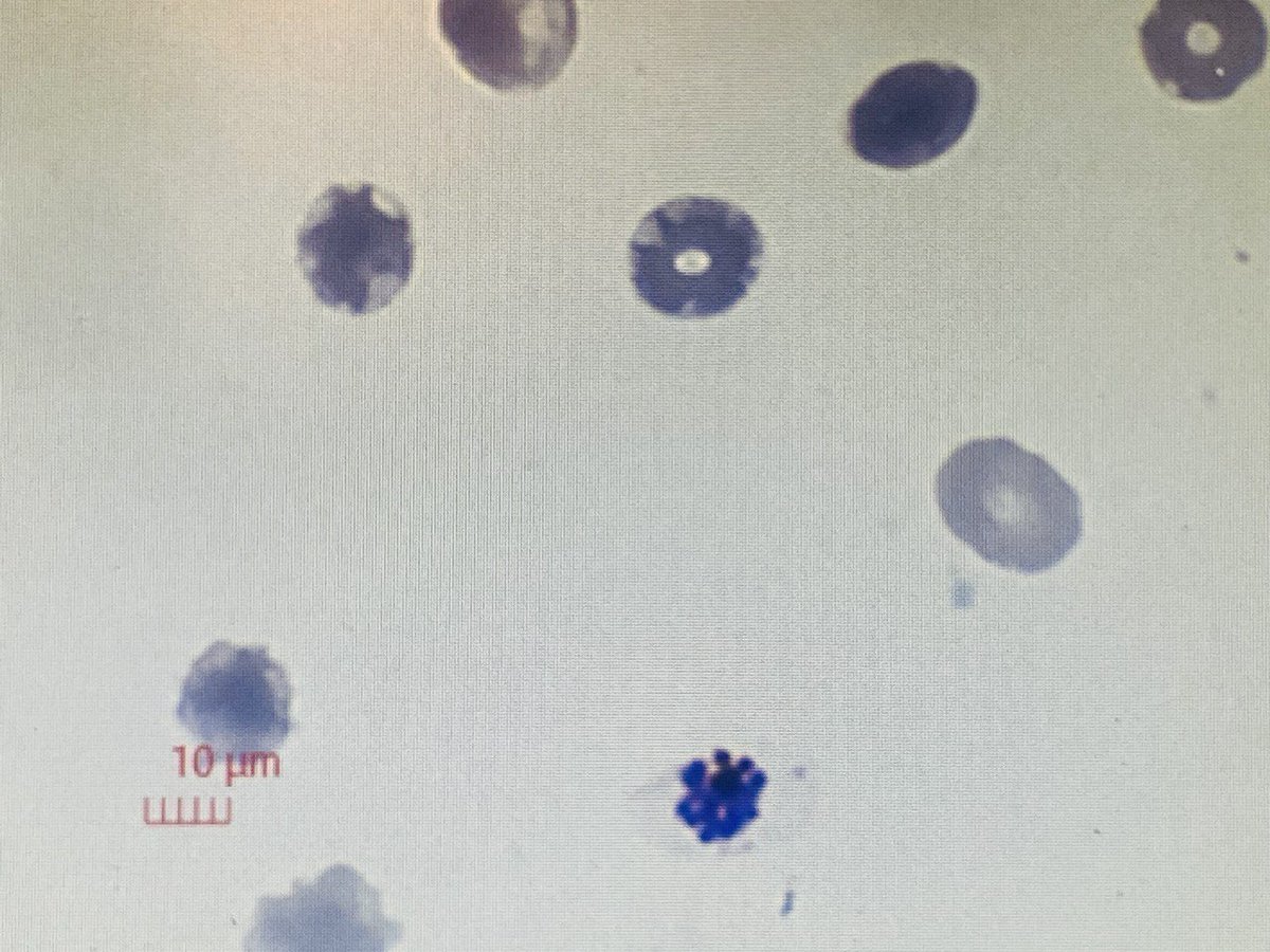 palak_sangal's tweet photo. Every flower blooms in its own time ๐ธ๐งฌ
#phdlife #plasmodiumbiology #schizont #phdvoice #parasitology https://t.co/yZ4IntaoNx