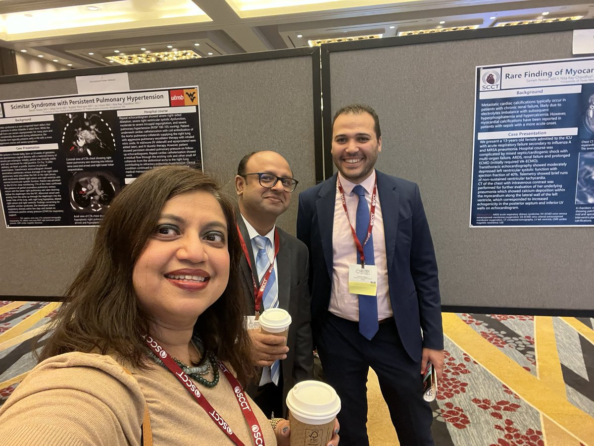 Nita Ray Chaudhuri, MD, FACC (@rayrcnita) on Twitter photo WVU took up the Educational section with CHD posters on Scimitar syndrome and Myocardial Calcifications at #SCCT2024 this weekend🫀❤️so proud of our fellow <a href="/SNassarMD/">Sameh Nassar</a> #CHD <a href="/anjali_chelliah/">Anjali Chelliah</a> <a href="/sudarshanballa/">Sudarshan Balla</a> <a href="/WVUMedSchool/">WVU School of Medicine</a> <a href="/WVUMedicine/">WVU Medicine</a> <a href="/CHD_education/">Pediatric/congenital cardiology education</a> <a href="/Heart_SCCT/">Heart_SCCT</a> 🫀❤️🫀❤️ WVU took up the Educational section with CHD posters on Scimitar syndrome and Myocardial Calcifications at #SCCT2024 this weekend🫀❤️so proud of our fellow <a href="/SNassarMD/">Sameh Nassar</a> #CHD <a href="/anjali_chelliah/">Anjali Chelliah</a> <a href="/sudarshanballa/">Sudarshan Balla</a> <a href="/WVUMedSchool/">WVU School of Medicine</a> <a href="/WVUMedicine/">WVU Medicine</a> <a href="/CHD_education/">Pediatric/congenital cardiology education</a> <a href="/Heart_SCCT/">Heart_SCCT</a> 🫀❤️🫀❤️