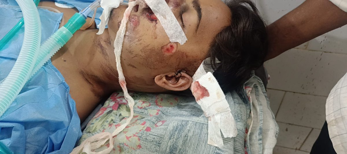 theabuzafar's tweet photo. ये मामला वही थाना का है जहा पूर्व मंत्री @sonofmallah मुकेश सहनी जी को दो दिन भी नहीं लगता है और इंसाफ मिल जाता है और एक परिवार का बेटा चला जाता है हफ्ता भर से ज्यादा हो गया है परिजन इंसाफ का गुहार लगा रहा है और बिहार पुलिस का अधिकारी कुछ करने को तैयार नहीं है। @helpline_BP https://t.co/2Jb0CQB1HY