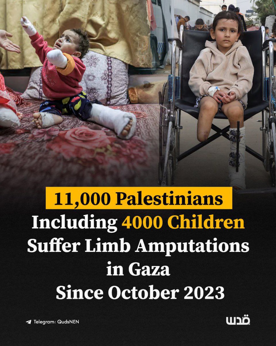 MANOUCHKYA's tweet image. 🇦🇪⚠️⚠️ Au moins 11 000 Palestiniens de Gaza, dont 4 000 enfants, ont subi des amputations d’un membre depuis le début de la guerre israélienne en octobre 2023.
Un enfant tué toute les 10 mns💔
#Gaza_life_matters 
#Gaza_in_Genocide