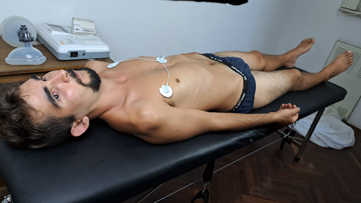 NickCpranddefib's tweet photo. Pincén is a psychiatric patient of Dr. Rodriguez. After failing to respond to drug treatment, he will try ECT treatment.
Preview: https://t.co/ksr1AbNxzP
Full version: https://t.co/FaUQt1dvl6

#ECT #seizure #resus #cpr #ambubag #defib #doctor #patient https://t.co/qhB7MkuNQ6