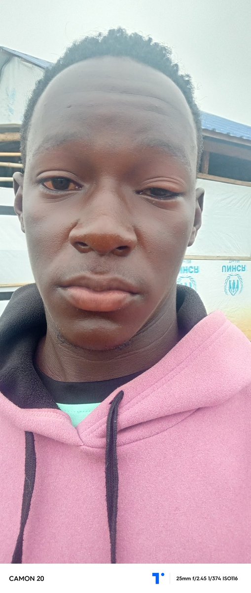 Hello world, hopefully you are all doing well there, I am currently in a very hard situation where I'm in need of urgent help and support since I happened to get a disease called red eyes I request for imediate support gofundme.com/f/stand-with-d…