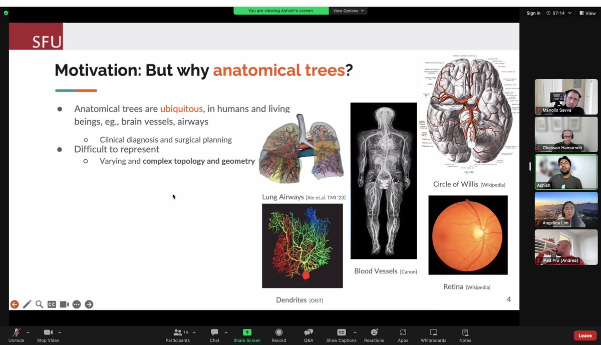 Hamarneh_MIA's tweet photo. Congratulations to Ashish Sinha for successfully defending his MSc thesis: Representation and Synthesis of 3D Biomedical Visual Data,  Papers:  DermSynth3D and TrIND https://t.co/SQO4fGchgI  Code:   https://t.co/Ig8SUVLiJW https://t.co/83vlh0Umz7 https://t.co/4m8Vl3zYm1