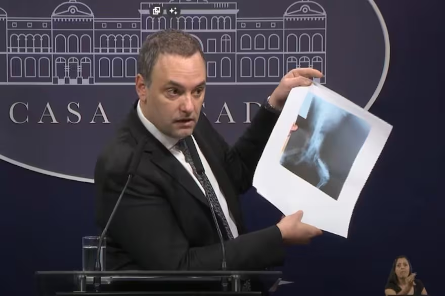 MatiAromi's tweet photo. ???? Manuel Adorni ayer baso su conferencia en una radiografía de un perro y resulta que esto ya había sido RECHAZADO. Decían que el ajuste lo pagaba la casta y lo estan pagando jubilados. Ahora quieren que también sacando pensiones por discapacidad. Gobierno de miserables. Fin. https://t.co/QYWQqYD92E