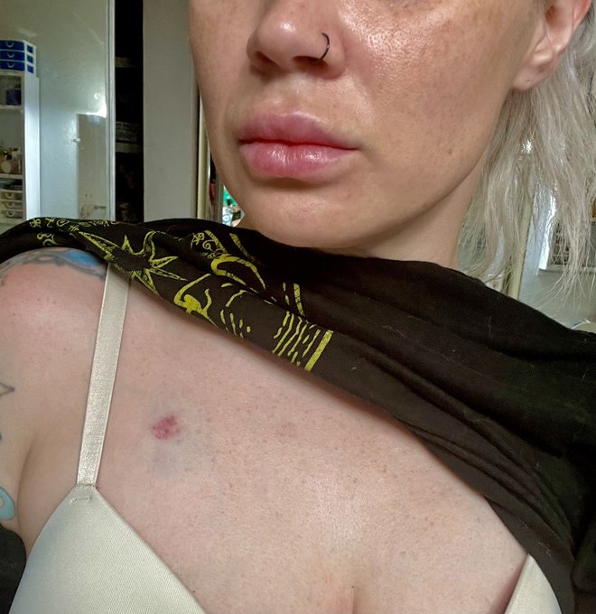 I don&rsquo;t know what makes a client feel that it&rsquo;s okay to fucking bite? This isn&rsquo;t the first time. I don&rsquo;t<a href="/tag/realloyalfans"class="tags"><span>#realloyalfans</span></a>