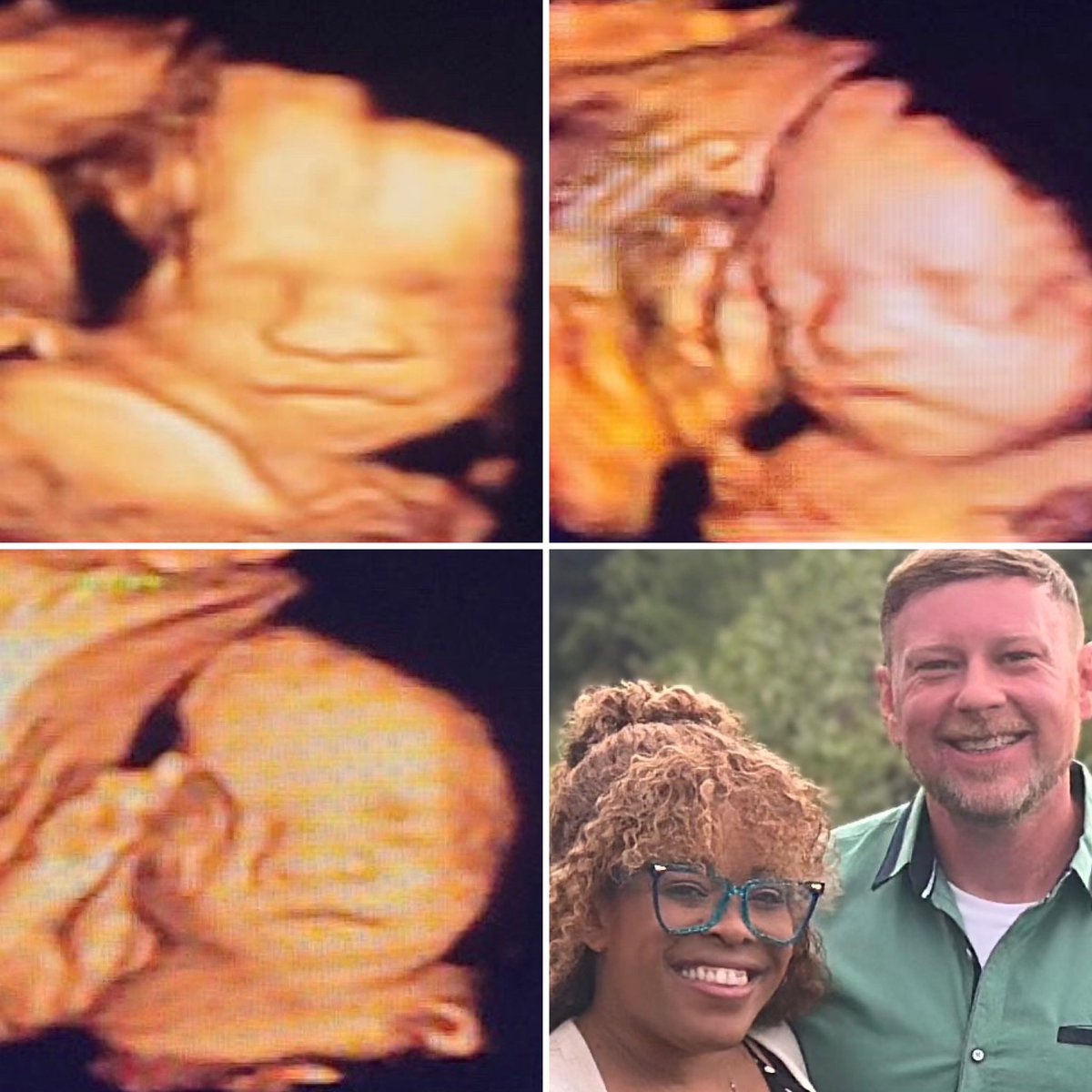 Kisha_Lurai's tweet photo. 25.5 weeks, come on October - He has the same face as the person I fell in love with. The man that my family and friends fell in love with. The best gift we planned, created and received this year. Daddy’s twin!! 😍💙🥰🫶🏾 https://t.co/vCjMarCb1e