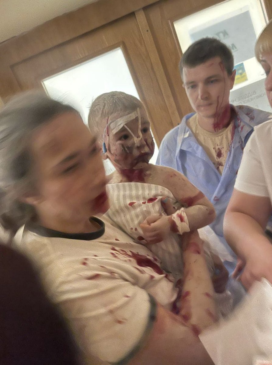 Kyiv, la photo du bombardement russe de l'hôpital pour enfants Okhmatdyt