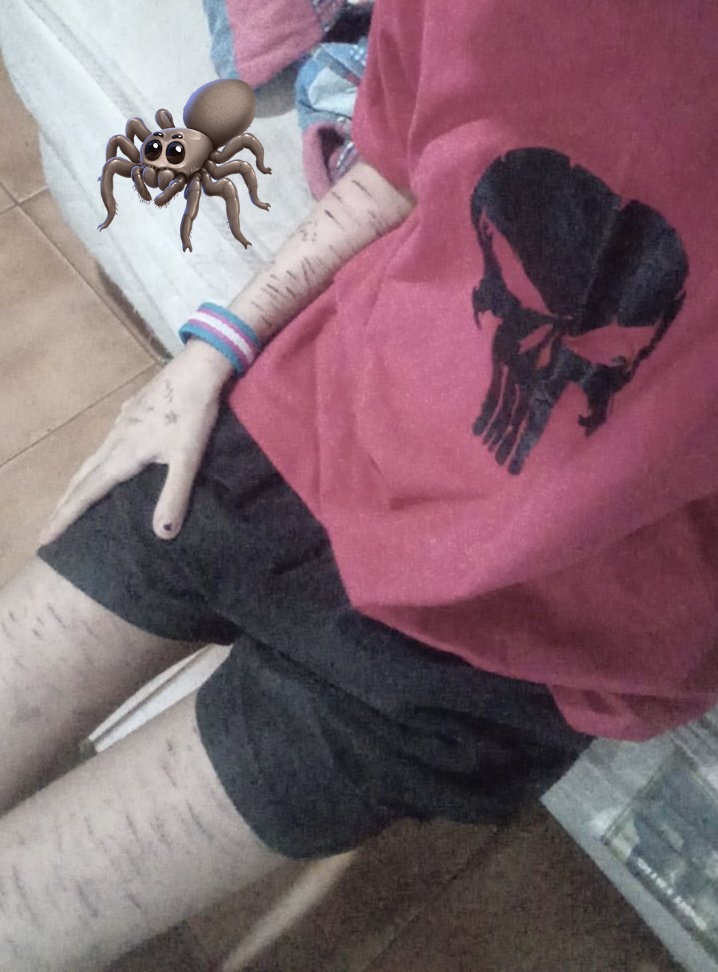 skinny :3