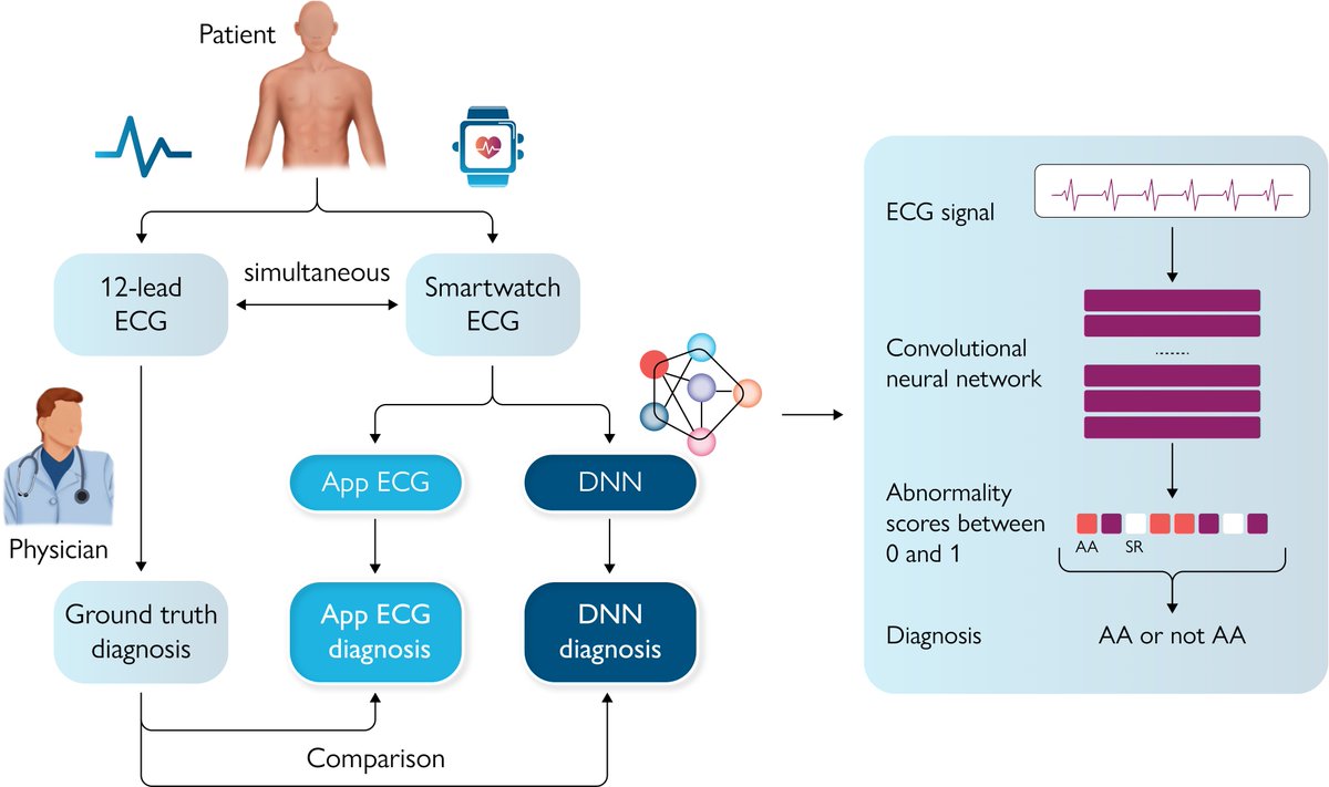 ESC_Journals's tweet image. #ArtificialIntelligence-based #ECG analysis improves atrial arrhythmia detection from a smartwatch ECG 👉 bit.ly/3Lihl4w 

#EHJDigital #mHealth @BruiningNico @rafavidalperez @GerdHindricks @rbcasado