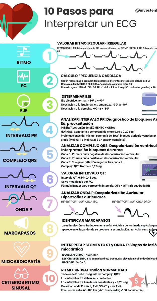 10 pasos para interpretar el EKG:
