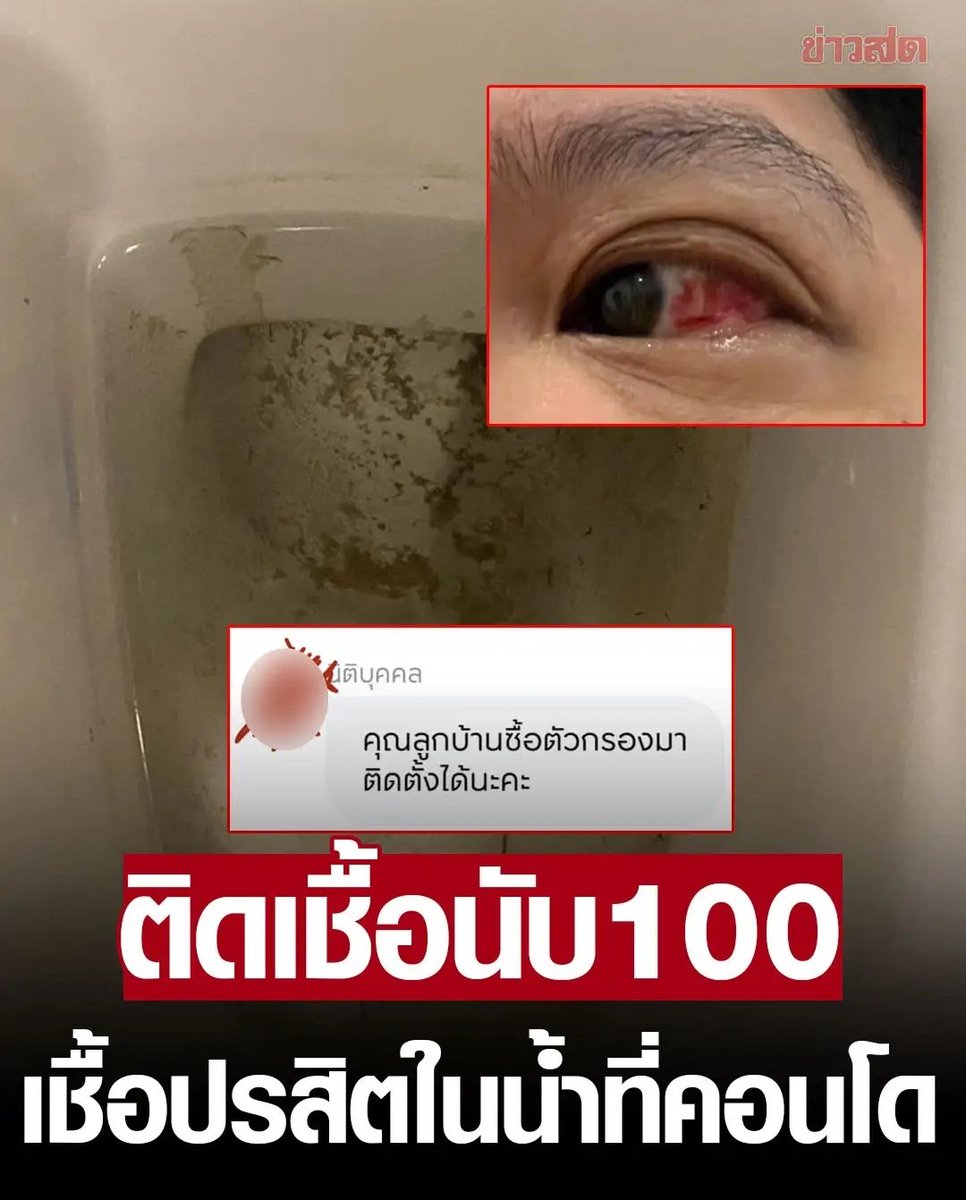 TarotYouuuu's tweet photo. น่ากลัวมากจริงๆ  คอนโดราคา 10 ล้านมีเชื้อปรสิตในน้ำ ติดเชื้อตาแดงเป็น 100 คน ถ้ามาช้ากว่านี้คือตาบอดแล้ว นิติคอนโดบอกให้ซื้อเครื่องกรองมาติดเอง ผลักภาระมาให้คนเช่าแบบนี้ได้ไง ไม่เข้าใจเลยจริงๆ!!!!! https://t.co/GKGNj3aPSo