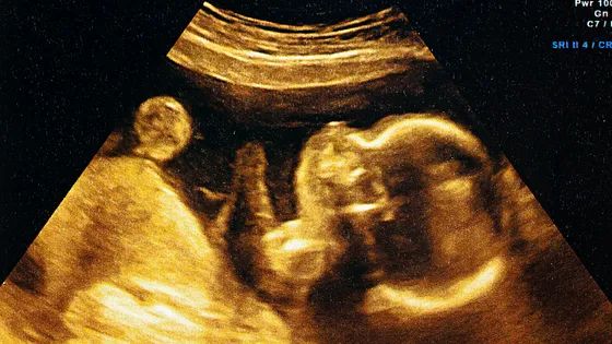 Est-ce qu’un bébé apprend déjà dans le ventre de sa mère ?
Par <a href="/StanDehaene/">Stanislas Dehaene @standehaene.bsky.social</a> sur <a href="/FranceInter/">France Inter</a> radiofrance.fr/franceinter/po…