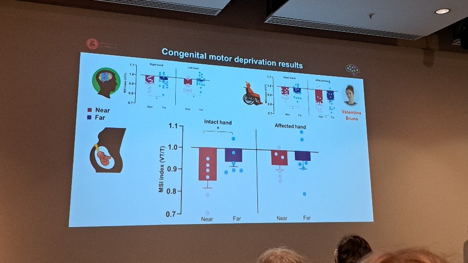 JannyStapel's tweet photo. Beautiful work by Francesca Garbarini teasing apart the impact of acquired and congenital motor problems on multisensory integration #ICIS2024 https://t.co/VhjtZZH6tS
