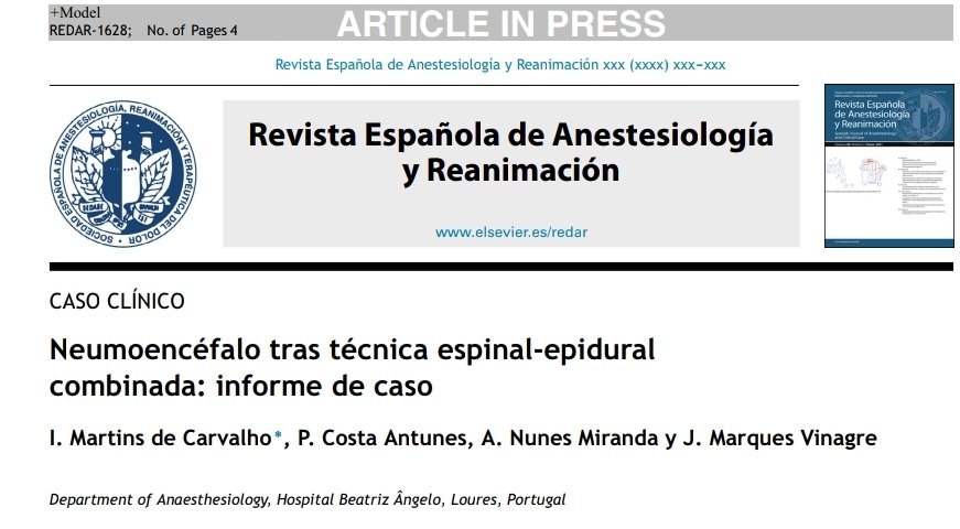 _REDAR_'s tweet photo. Neumoencéfalo tras colocación de catéter epidural... 2ml de aire bastan‼️
Puedes leer la revisión a propósito de un caso aquí 👇🏻👇🏻👇🏻
https://t.co/Cztpez0DOp https://t.co/gy6kK5q4OZ