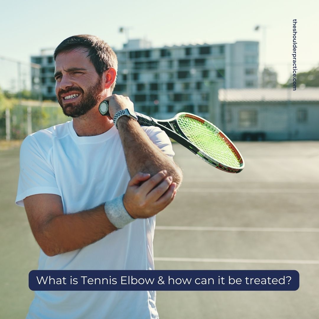 Tennis elbow, or lateral epicondylitis, is a painful condition caused by overuse of the arm, forearm, and hand muscles, leading to inflammation of the tendons in your elbow. Book an appointment with our team for a personalised treatment plan. #tennis #tenniselbow #wimbledon