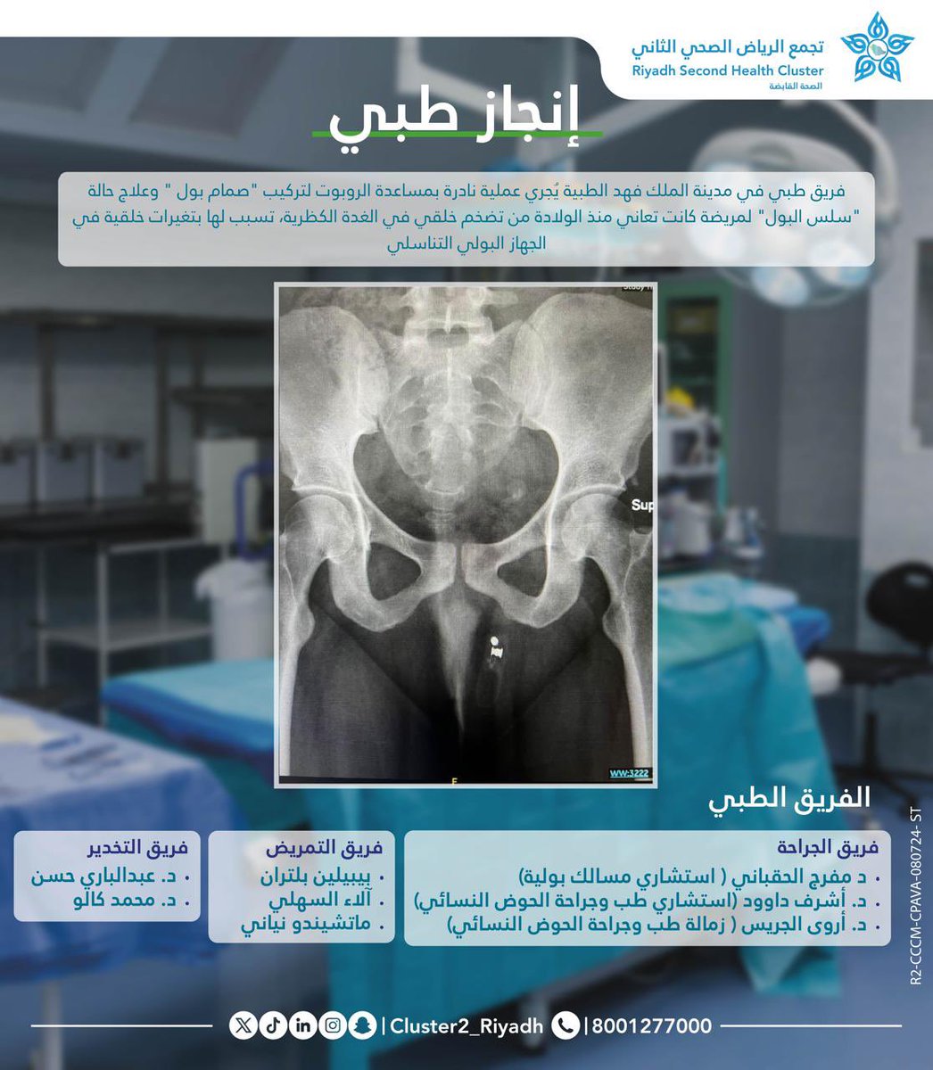 #إنجاز_طبي 
إجراء عملية نادرة بمساعدة " الروبوت " لتركيب "صمام بول " وعلاج حالة "سلس البول"  لمريضة تعاني منذ الولادة من تضخم خلقي في الغدة الكظرية
في #مدينة_الملك_فهد_الطبية 

#تجمع_الرياض_الصحي_الثاني