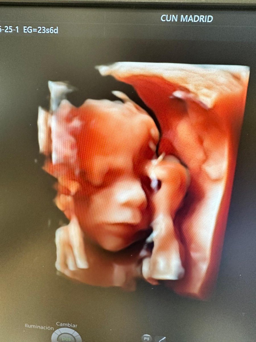 ErnestoMaria10's tweet photo. #PL1904SIM
ABORTO NÃO 

REAGE BRASIL 
ORAÇÃO, JEJUM E PENITÊNCIA https://t.co/ACkmlcKo8E